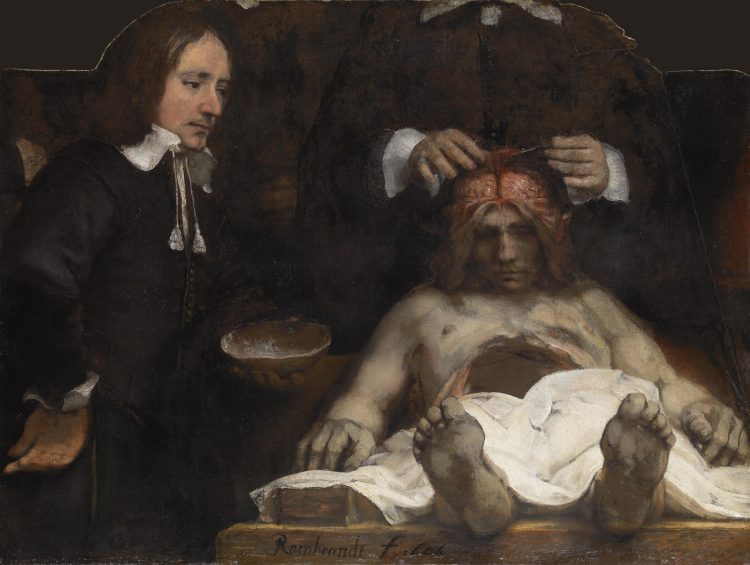 The anatomy lesson of Dr. Joan Deyman/Rembrandt. Foto: Amsterdam Museum
