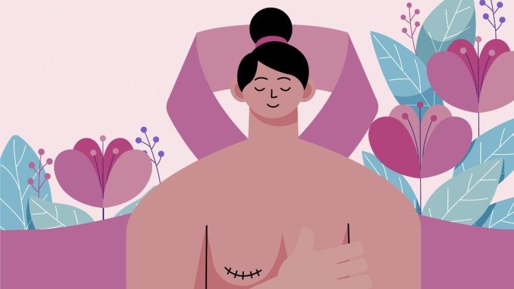 Ilustración referencial de una mujer con cáncer de mama y su salud mental en Bolivia